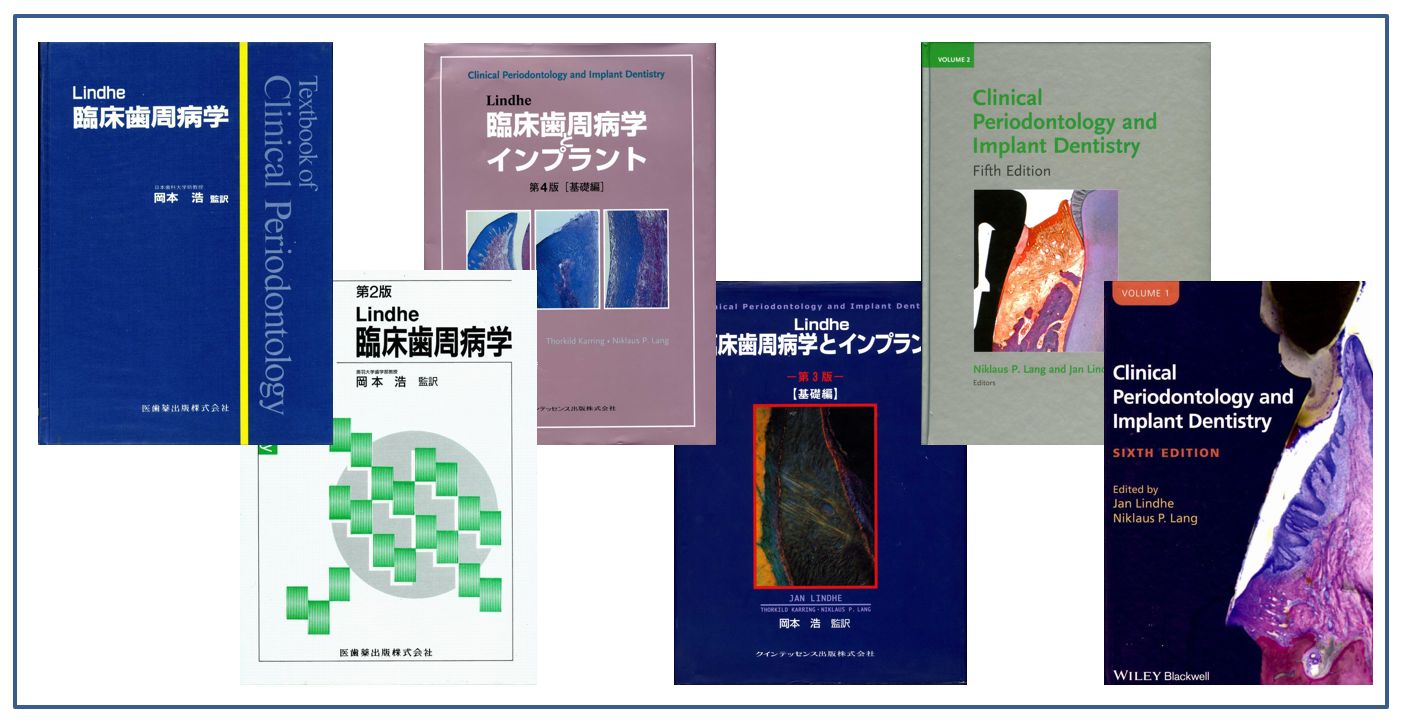 Ｌｉｎｄｈｅ臨床歯周病学とインプラント 基礎編 第４版 - 健康/医学